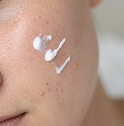 image-476 18 Skincare Mistakes Most People Make (And How to Fix Them Fast)